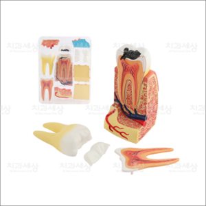 치아 조립모형치아형태/양치교육/치아교육/과학교육/어린이선물/치아모형